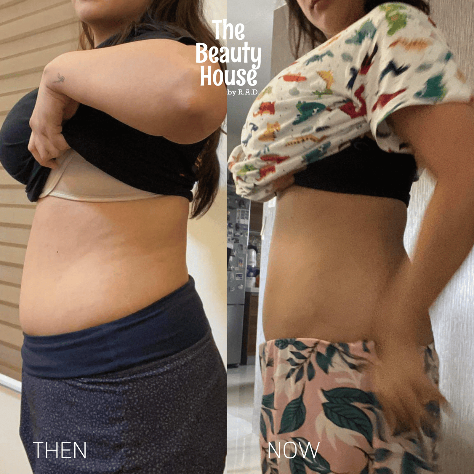 Lemon Bottle Fat Dissolve