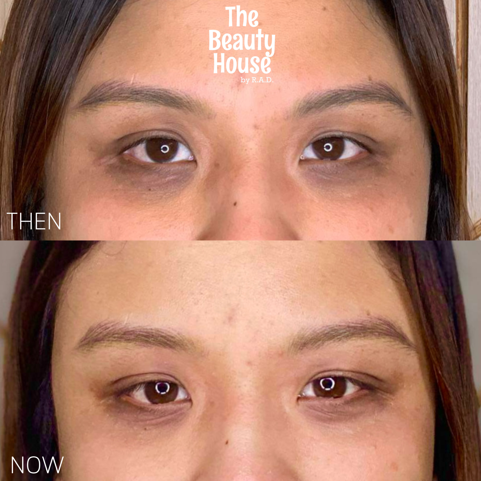 Aqua Eye Booster