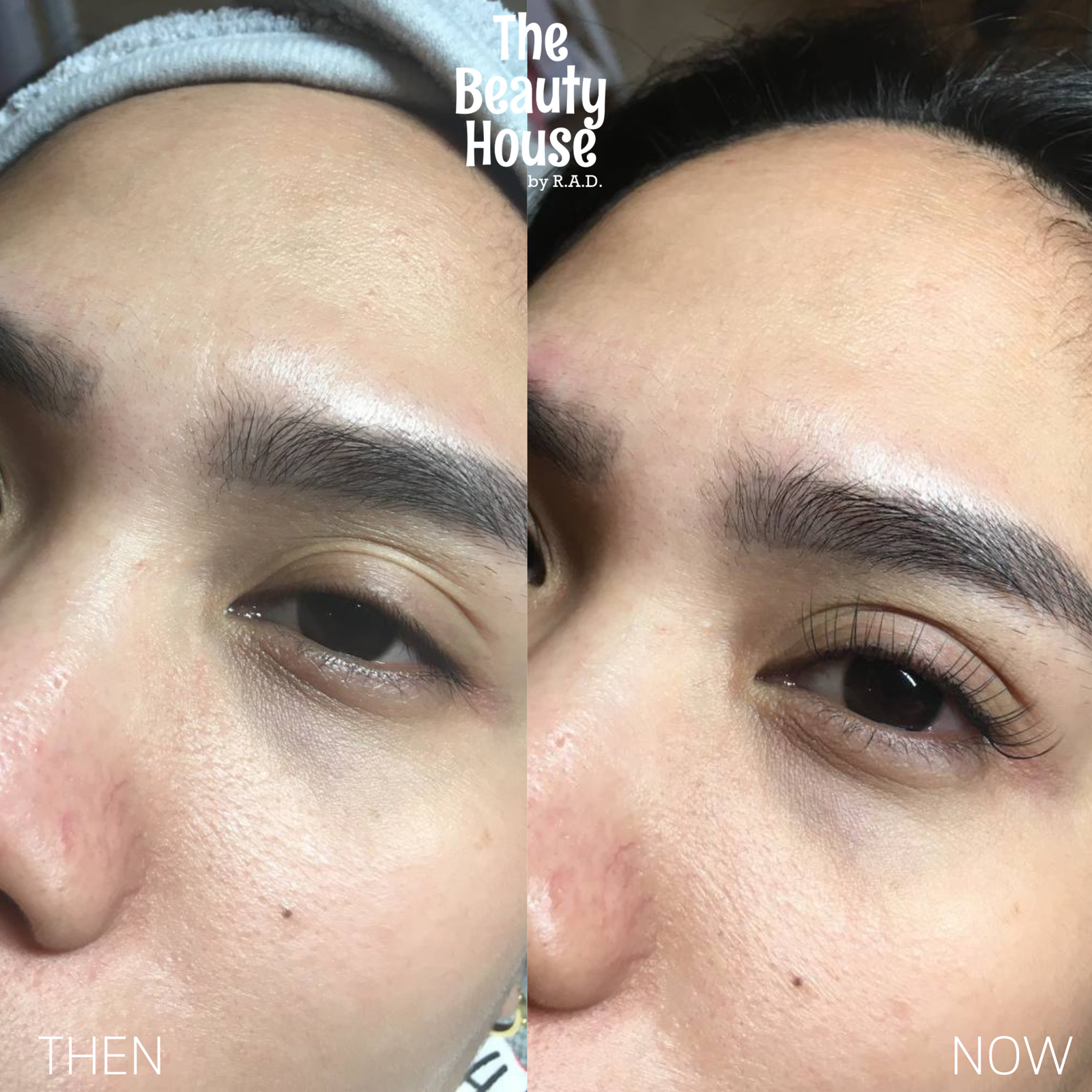 Eyelash Extension – Classic